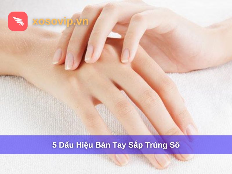 Các dấu hiệu bàn tay sắp trúng số