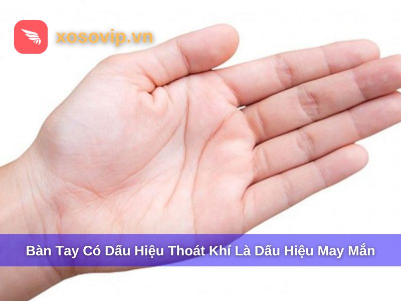 Lòng bàn tay may mắn thường có dấu hiệu thoát khí