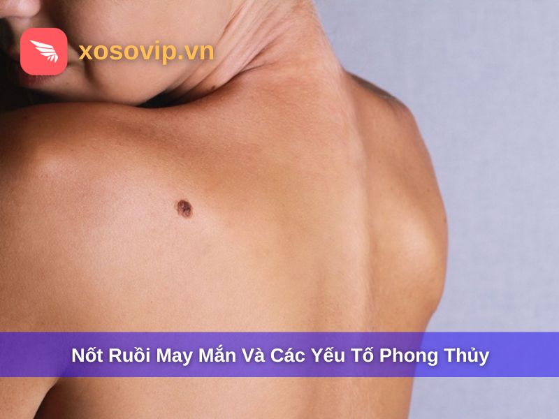 Nốt ruồi may mắn và các yếu tố phong thủy