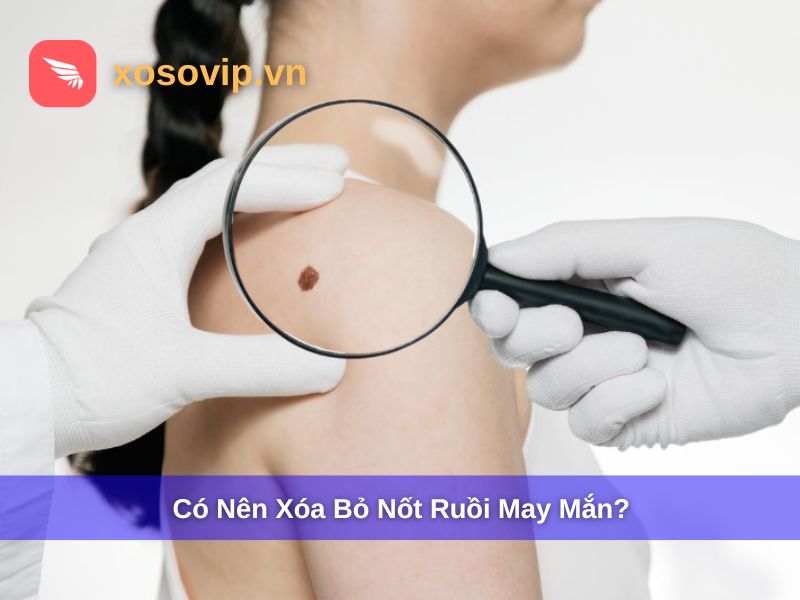 Nốt ruồi may mắn và các yếu tố phong thủy
