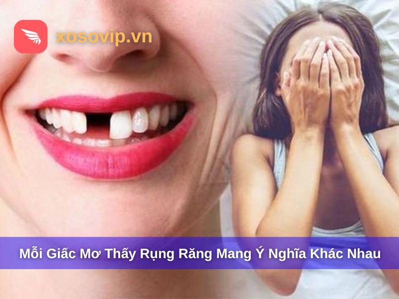 Rụng răng đánh con gì còn phụ thuộc vào chi tiết trong mơ
