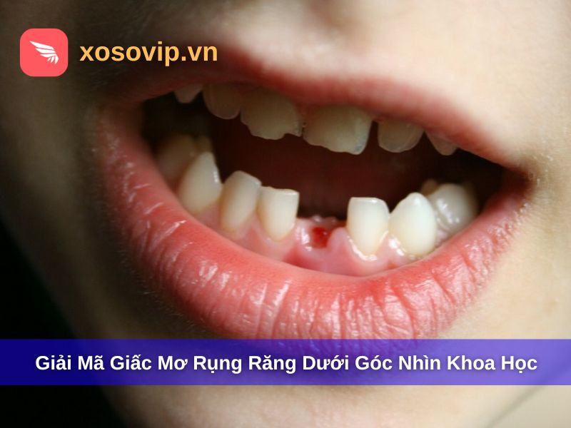 Giải mã giấc mơ rụng răng dưới góc nhìn khoa học